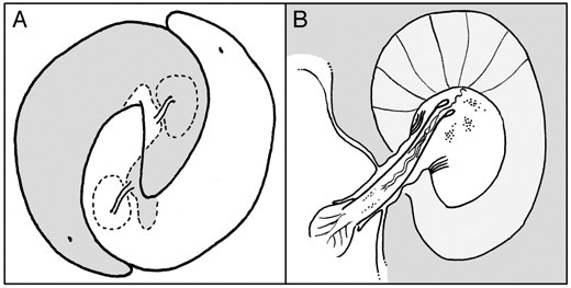 Macrostomum lignano in copula